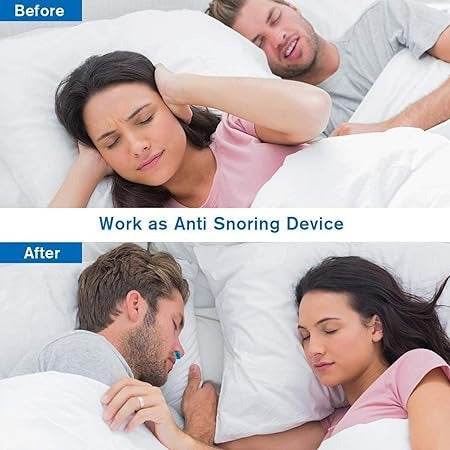Anti Snoring Device - DMC Wholesale