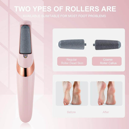 Electric Pedicure Foot File And Callus Remover - DMC Wholesale