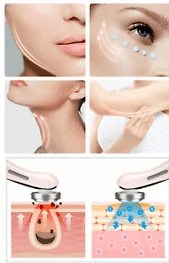 Photon Skin Beautifier - Alt View